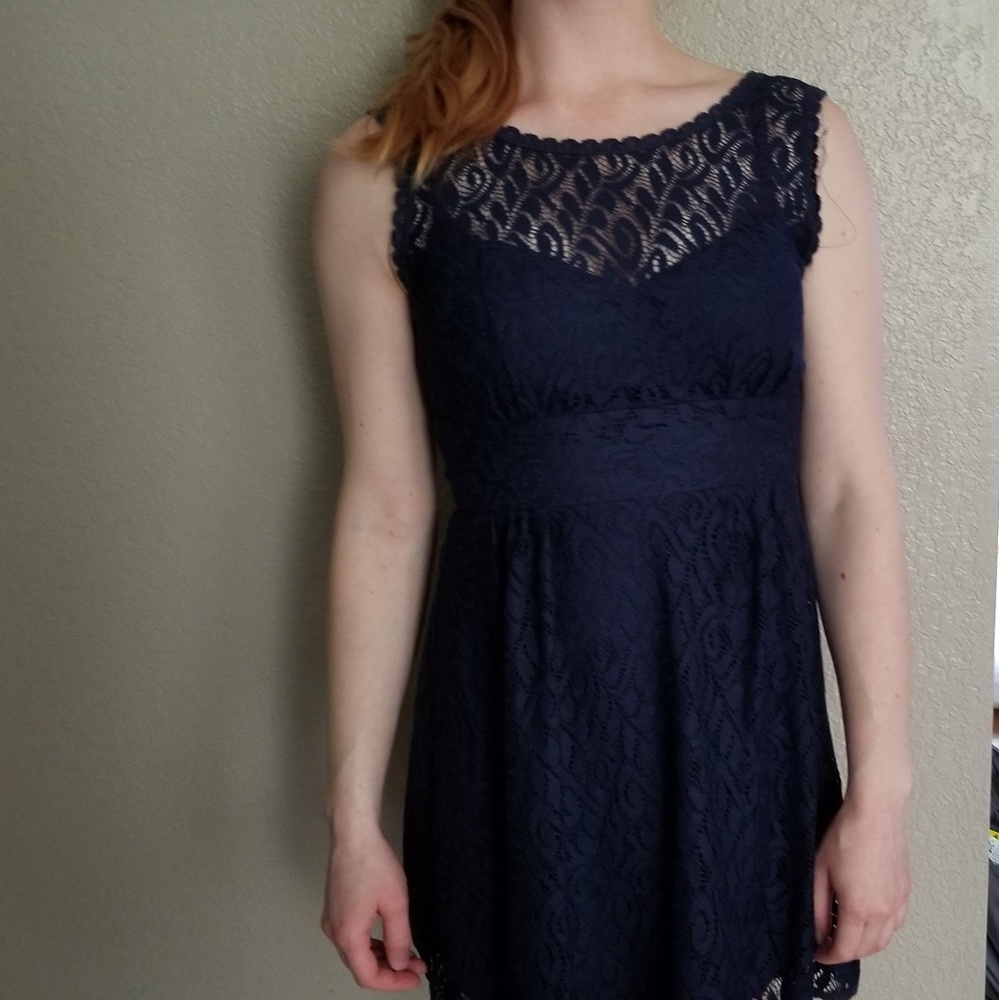 Elegant Lace Dress
